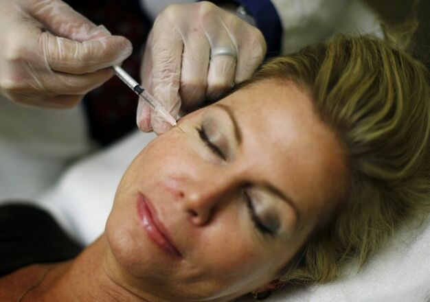 Introducción de rellenos en la piel de la cara un método de inyección de estiramiento