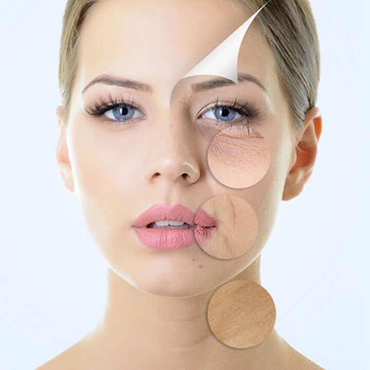 Imperfecciones de la piel del rostro indicaciones para procedimientos anti-envejecimiento. 
